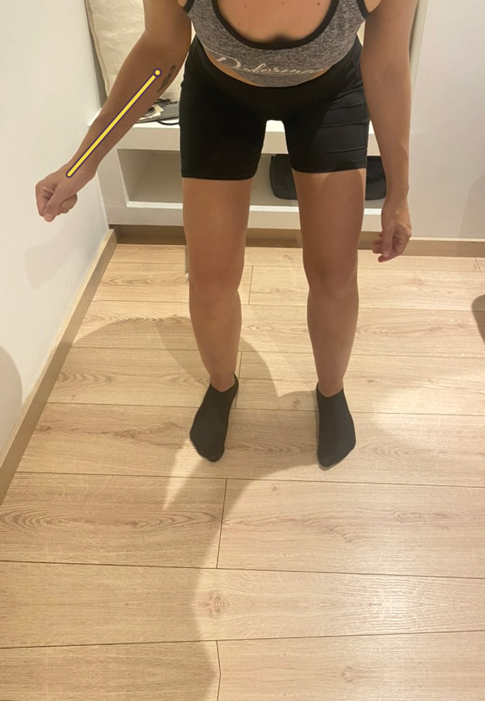 Antes: inclinación hacia delante con el brazo izquierdo más cerca del cuerpo
